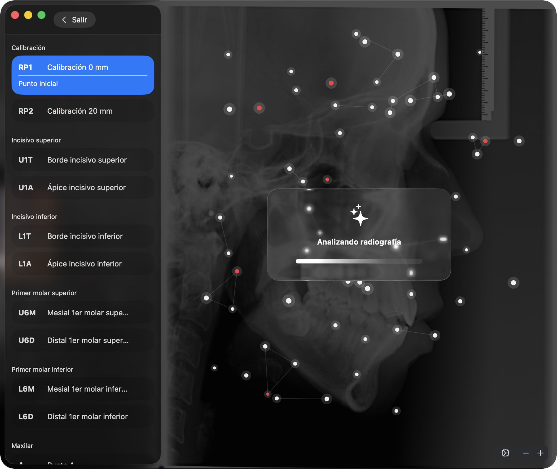 IA-Assisted Ceph analyzing a lateral skull radiograph in OrthoKit