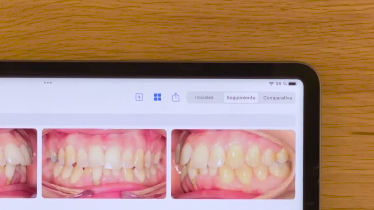 Comparativa y seguimiento en iPadOS - captura 1
