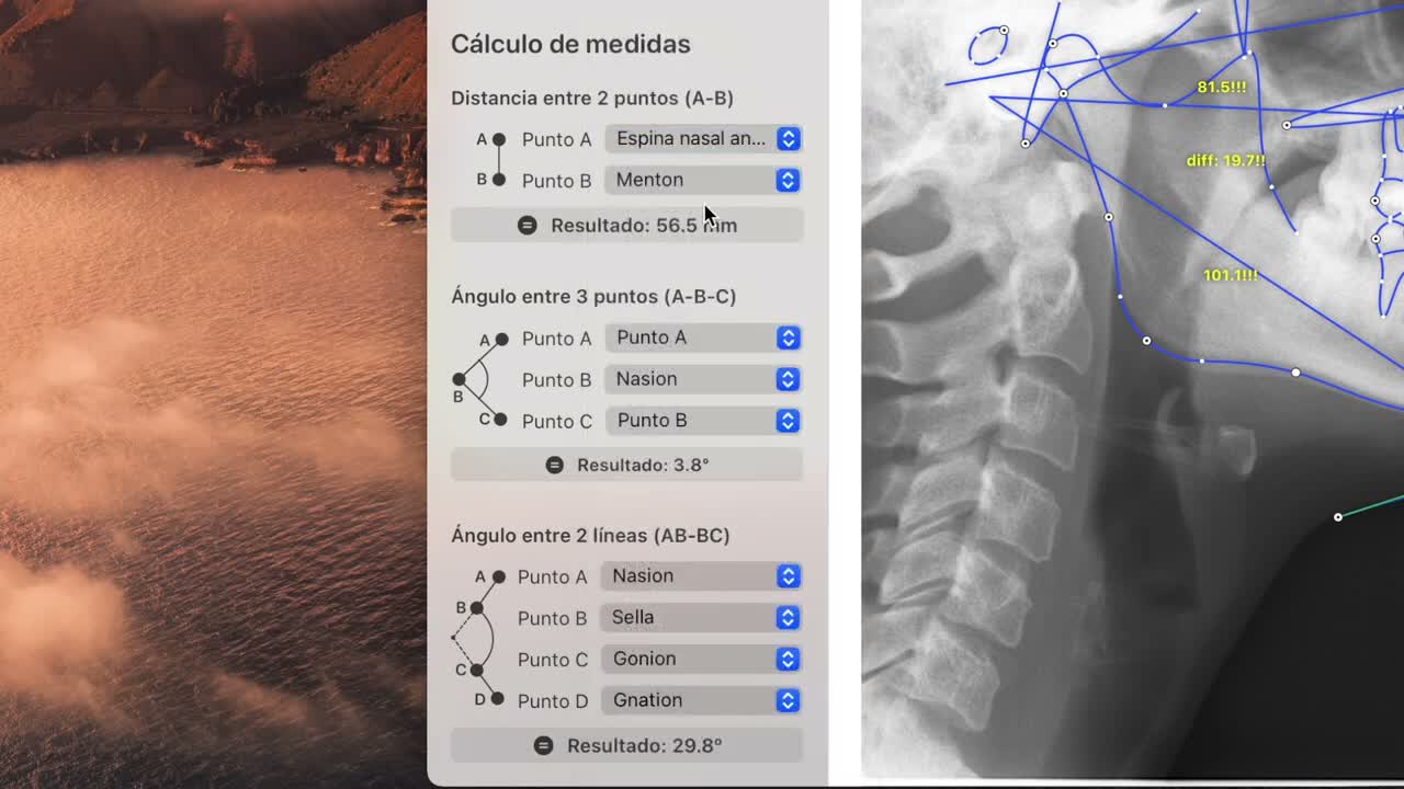 Cephalometric tracing on iPadOS - screenshot 6