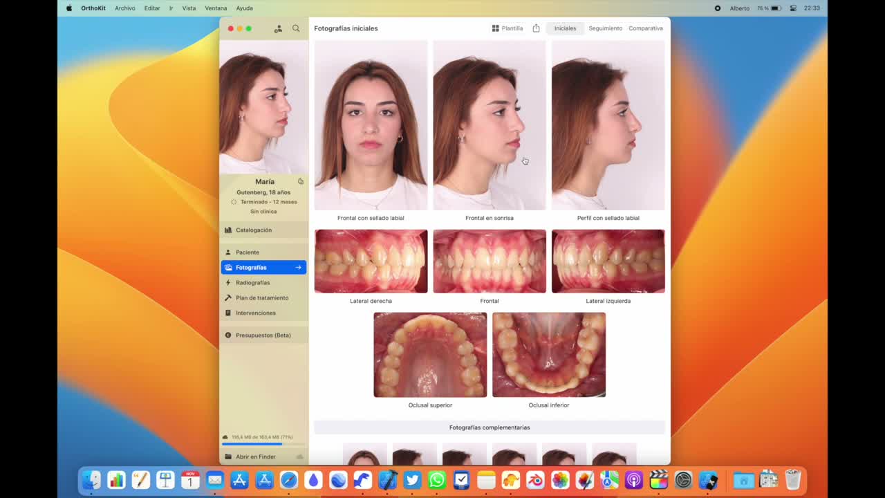 Fases y auto-recorte en macOS - captura 1
