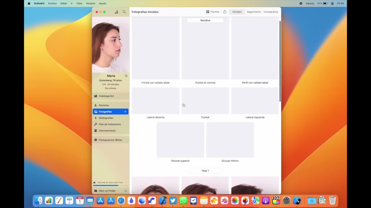 Fases y auto-recorte en macOS - captura 2