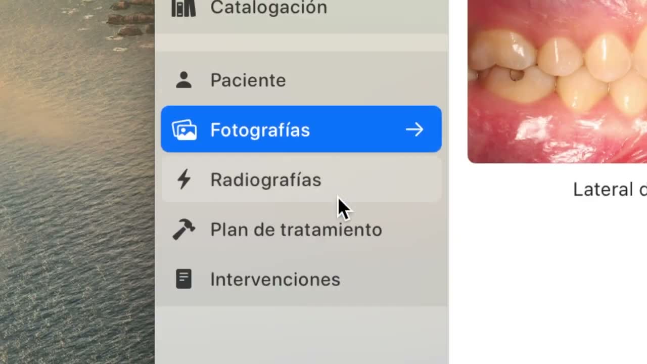 Radiograph import on macOS - screenshot 1