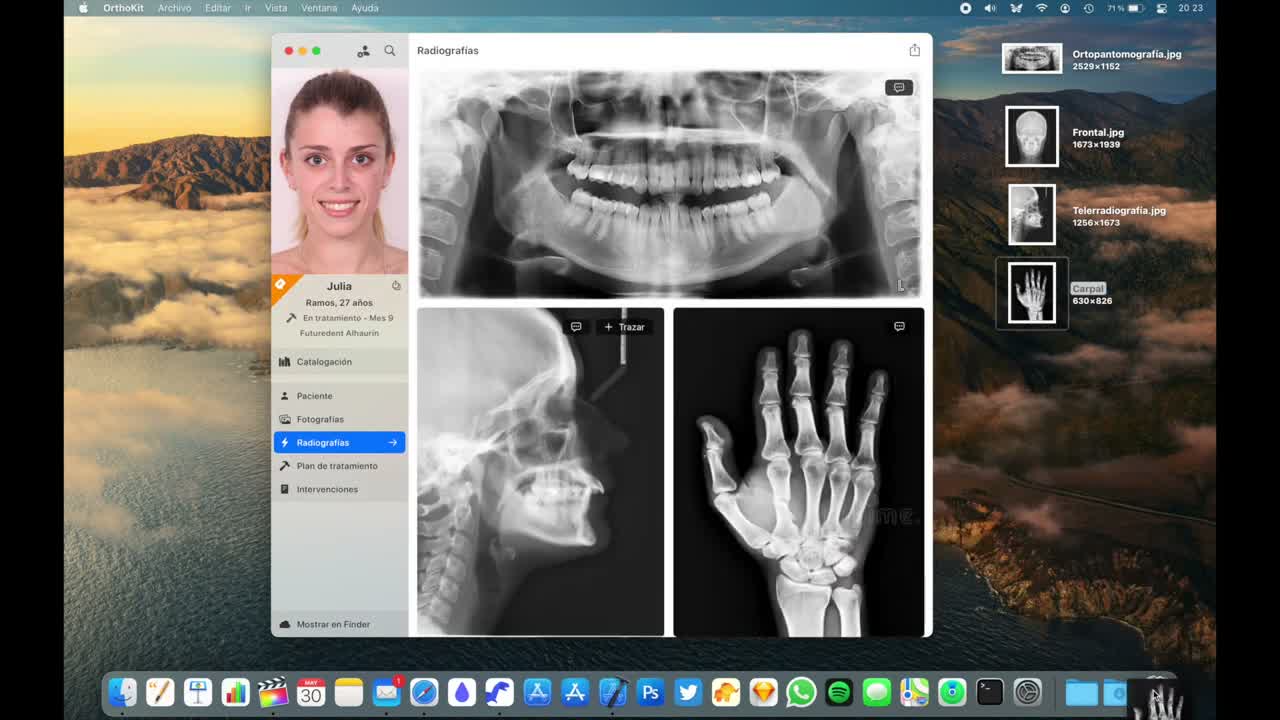Radiograph import on macOS - screenshot 2