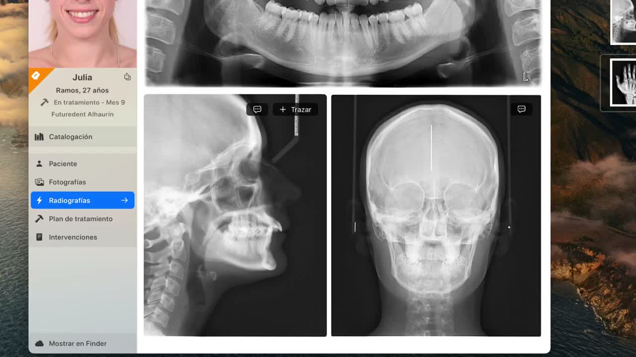 Radiograph import on macOS - screenshot 3
