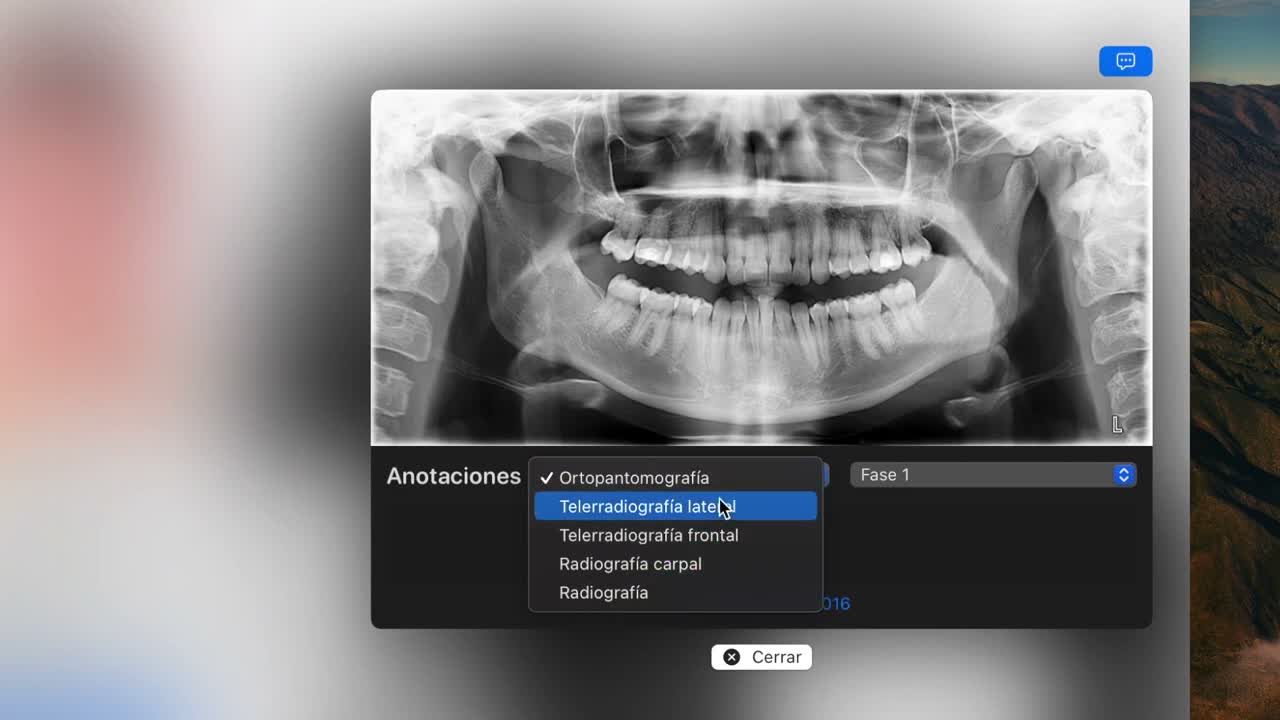 Radiograph import on macOS - screenshot 4