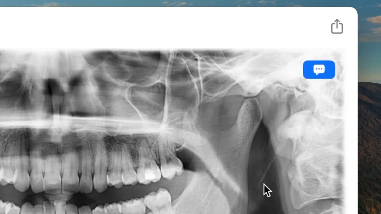 Radiograph import on macOS - screenshot 5