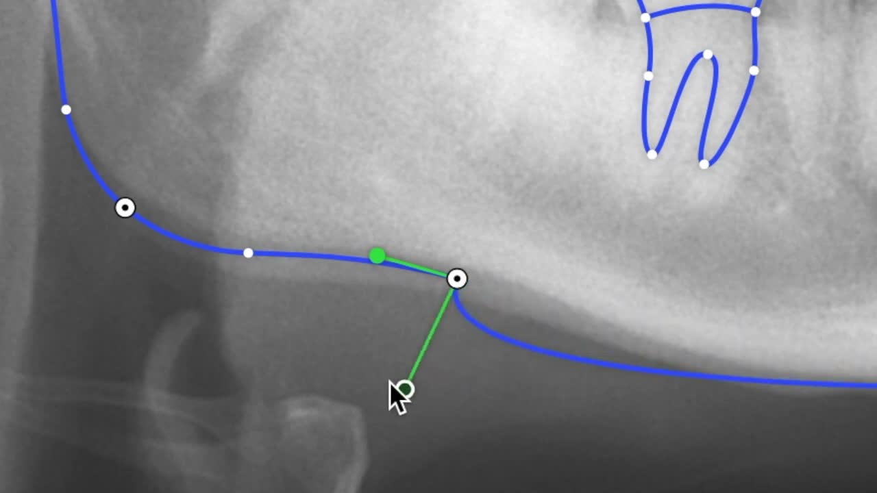Cephalometric tracing on macOS - screenshot 4